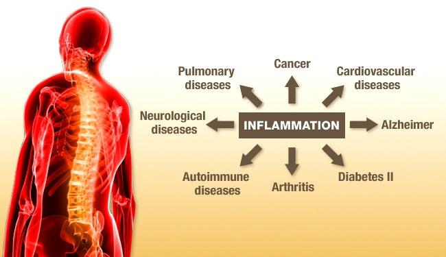 14 Natural Anti Inflammatory Foods