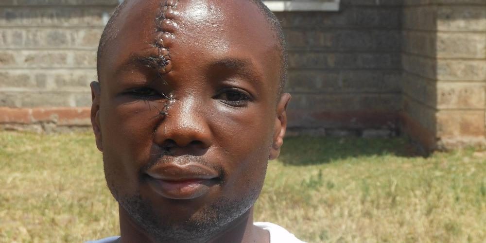 This Man Took a Machete To The Face Defending An Orphanage