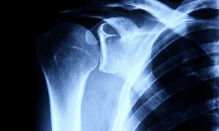 Scientists Discover Nano-shells Deliver Molecules that Tell Bone to Repair Itself