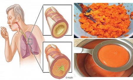 This Ancient Homemade Syrup Removes Phlegm From Your Lungs and Cures Cough
