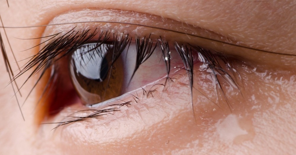 Looking At Tears Under A Microscope Reveals A Shocking Fact