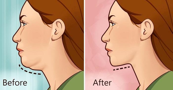 get-rid-of-double-chin-with-this-exercise-in-only-10-days-video