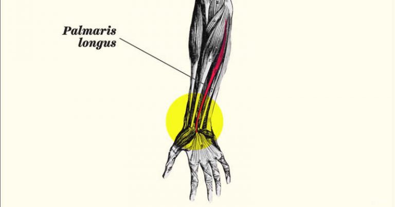 If Your Tendon Pops Out On Your Wrist Like This, This Is What It Means 