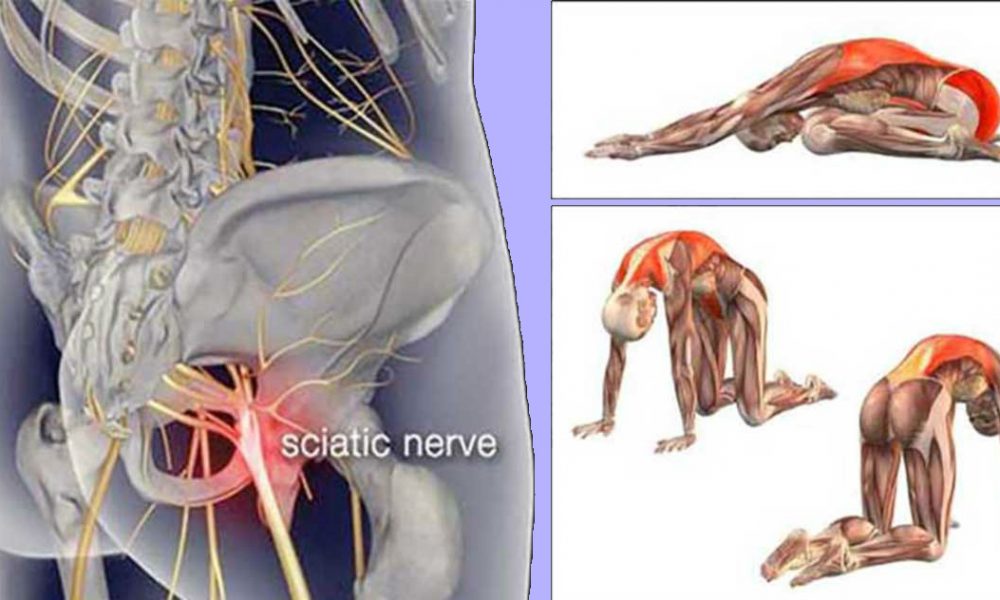 11 Piriformis Stretches to Get Rid of Sciatica, Hip and Lower Back Pain
